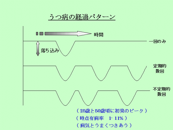 うつ病の経過パターン